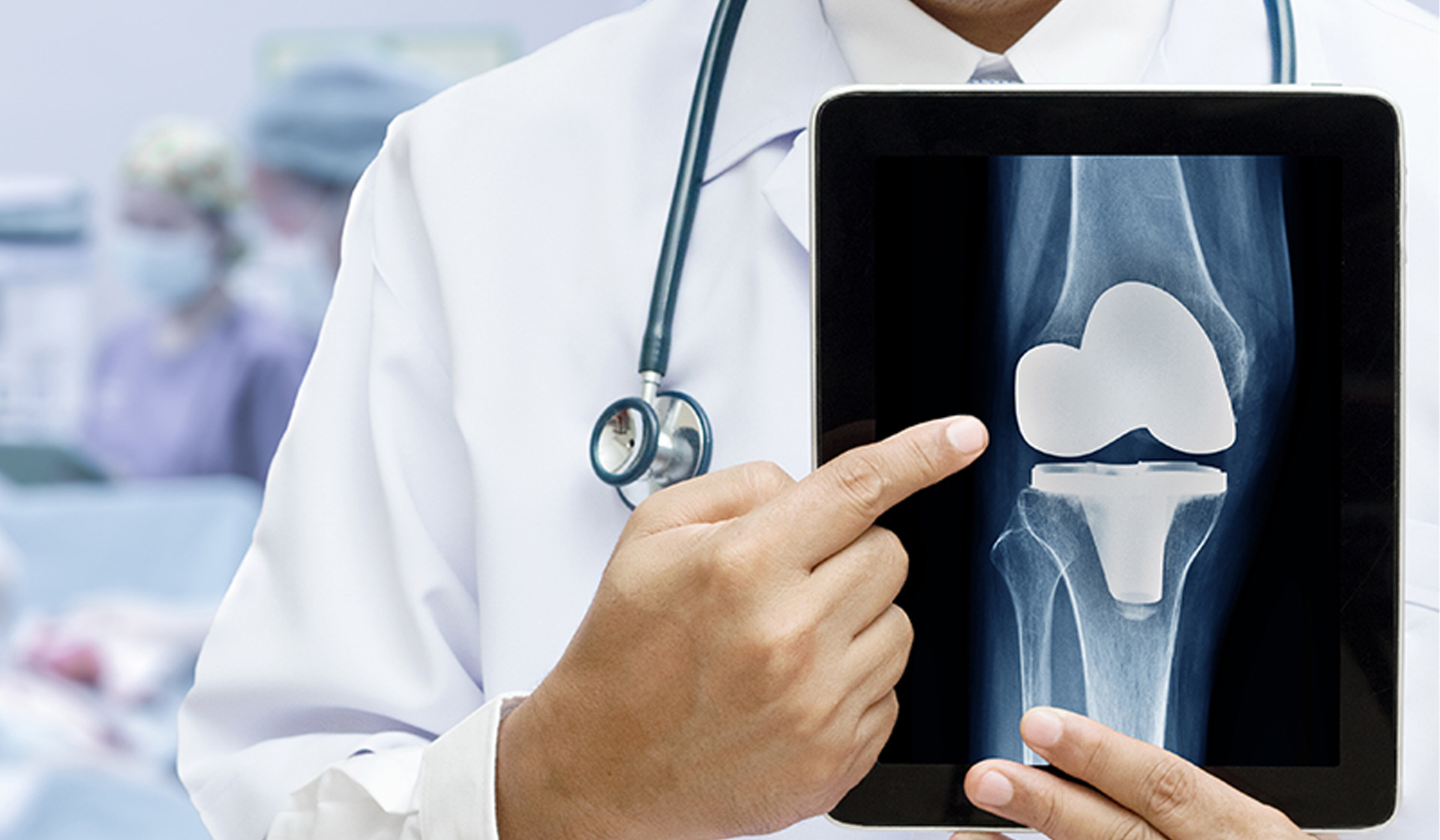Primary Joint Replacement Surgeries